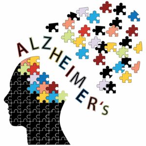 Alzheimer's Care in Scottsdale